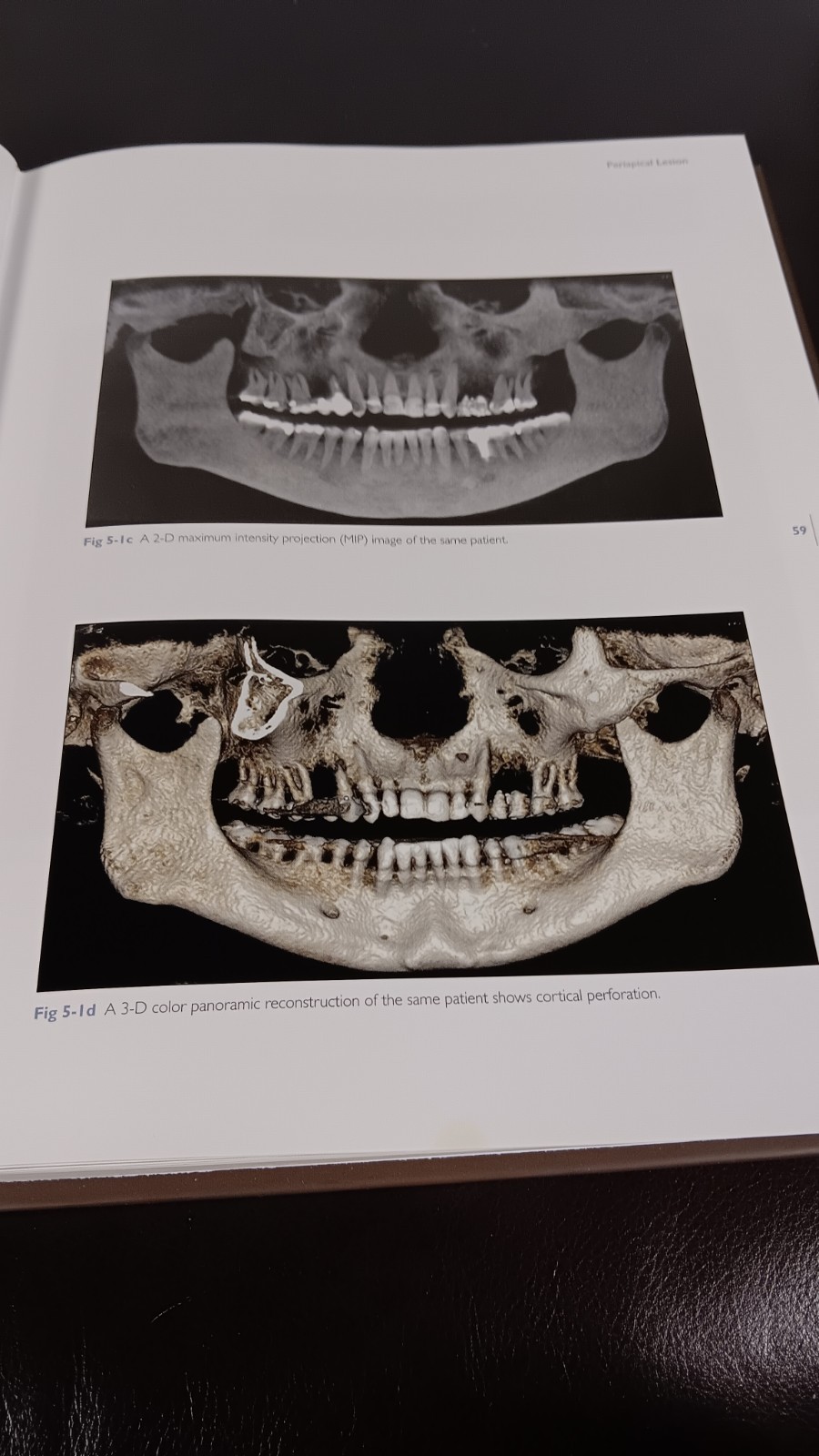 COLOR ATLAS OF CONE BEAM VOLUMETRIC IMAGING FOR DENTAL APPLICA TIONS Dale Miles