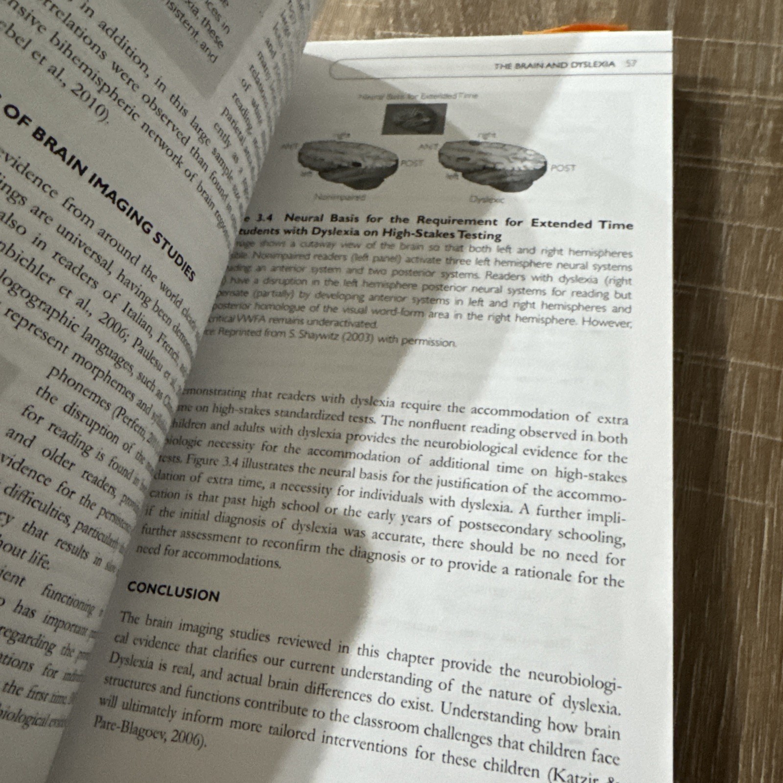 Essentials of Psychological Assessment Ser.: Essentials of Dyslexia… (N7)