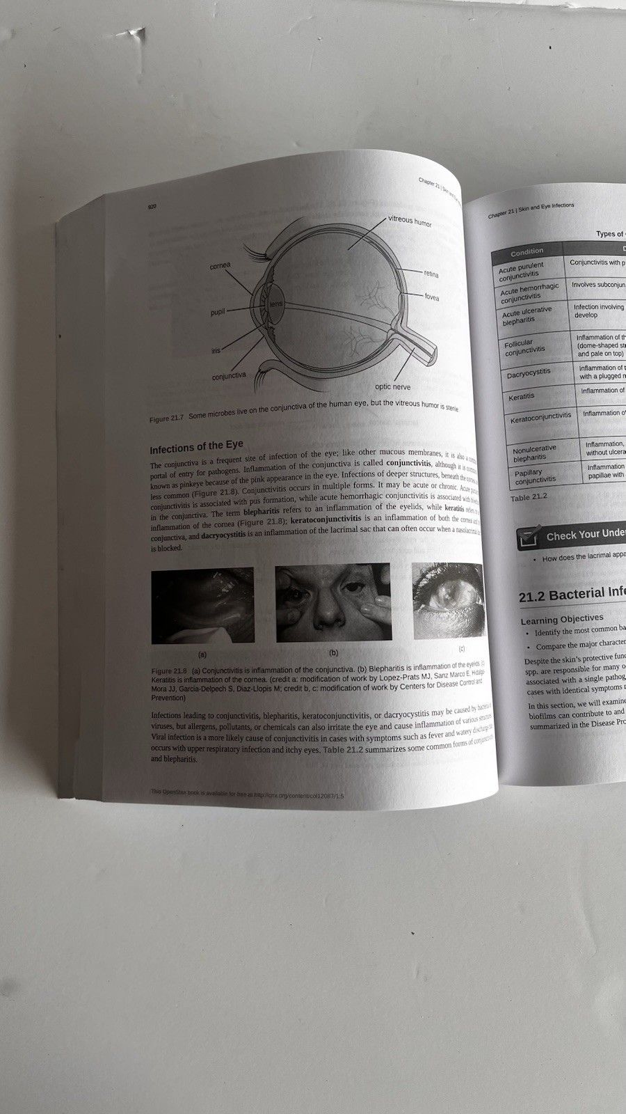 OpenStax Microbiology Hardcover Textbook Part 2 Only By ASM Press