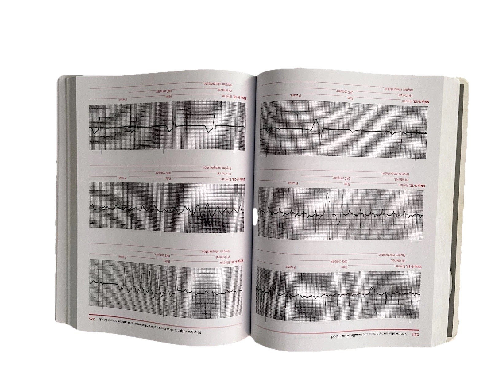 ECG Workout : Exercises in Arrhythmia Interpretation by Jane Huff -6th Edition
