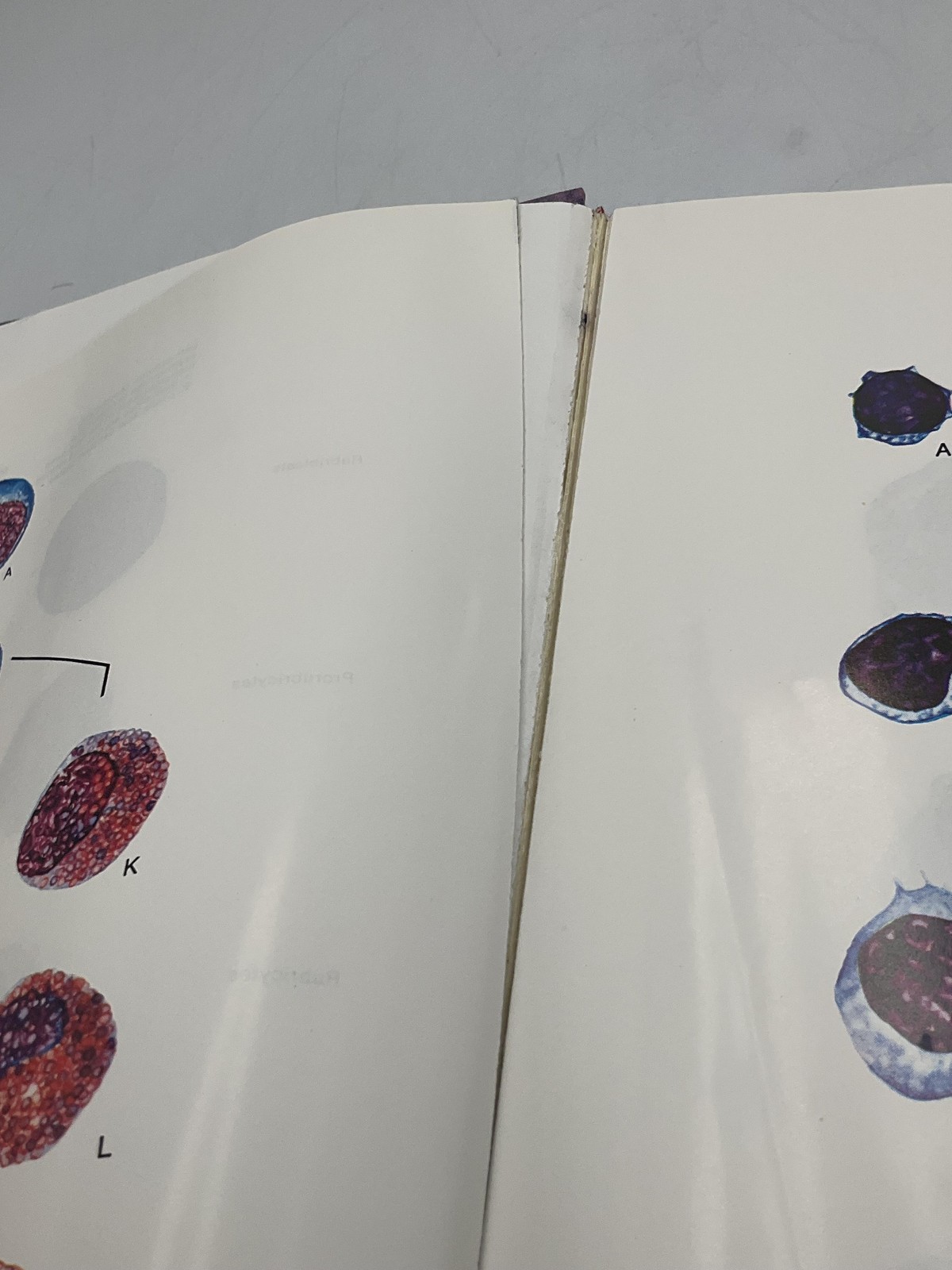 Clinical Hematology & Fundamentals Of Hemostasis Harmening 2nd edition HC