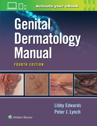 Peter Lynch Elizabeth Edward Genital Dermatology Manua (Paperback) (UK IMPORT)