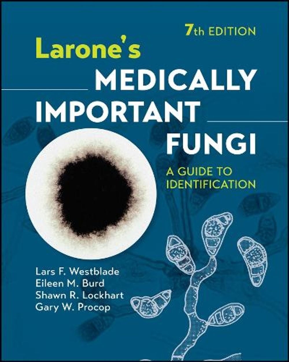 Larone’s Medically Important Fungi: A Guide to Identification by Lars F. Westbla