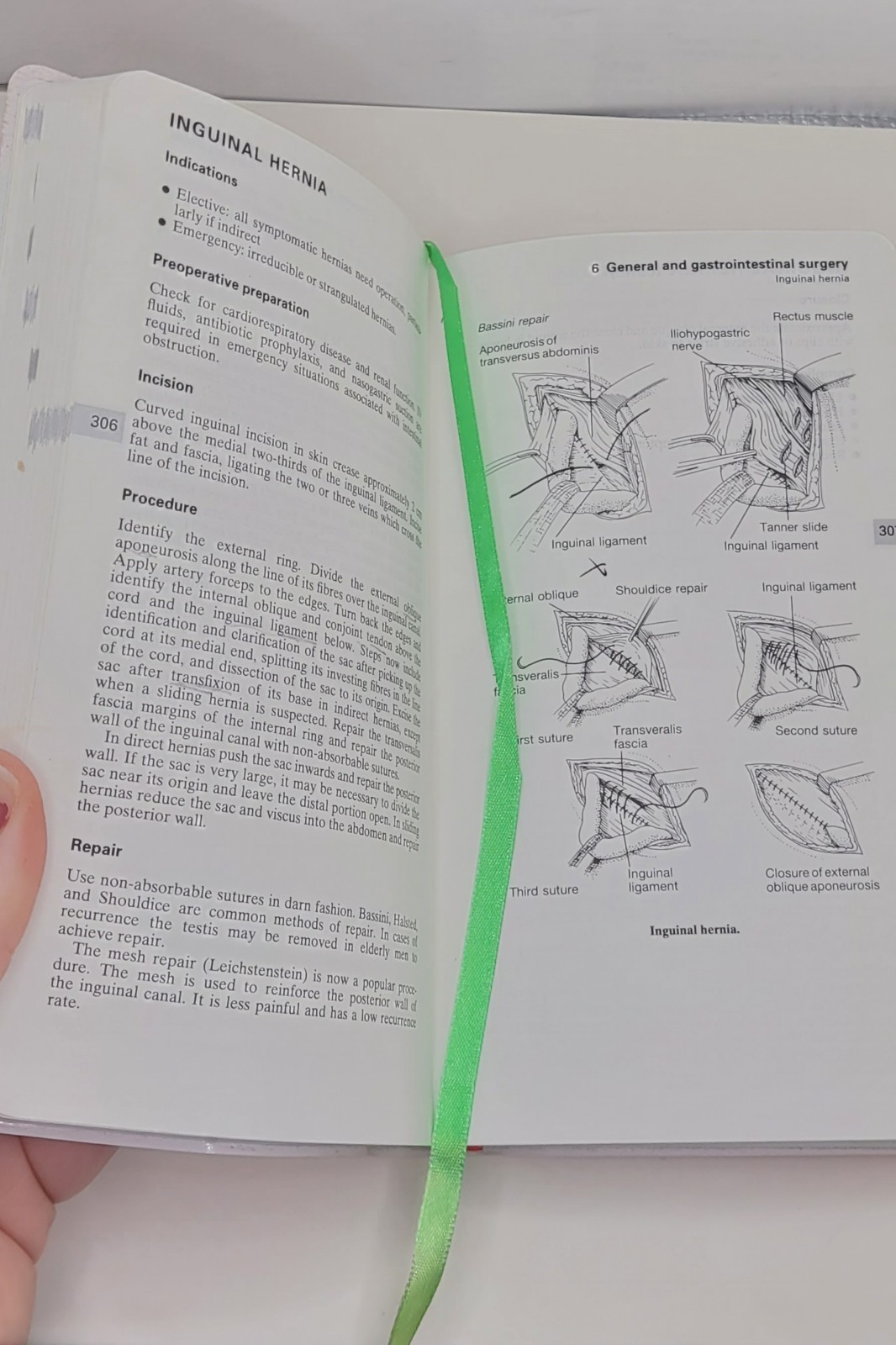 Oxford Handbook of Operative Surgery by D. J. Leaper 1996 Uk-Trade Paper