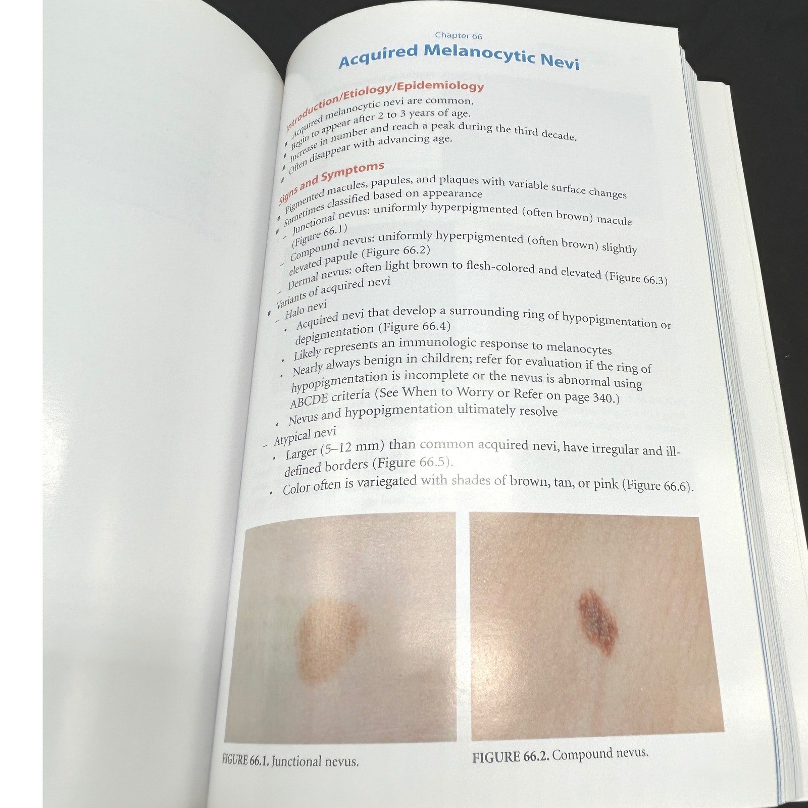 Pediatric Dermatology A Quick Reference Guide AAP Krowchuk Mancini 9781581102208