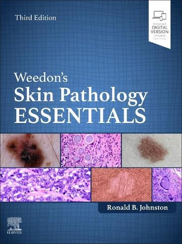 Weedon’s Skin Pathology Essentials by Ronald Johnston – 9780702084478