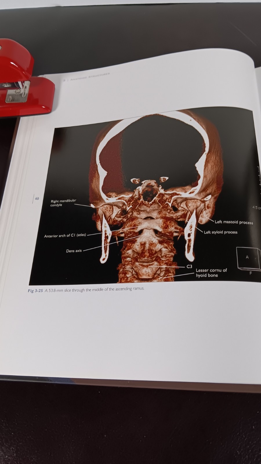COLOR ATLAS OF CONE BEAM VOLUMETRIC IMAGING FOR DENTAL APPLICA TIONS Dale Miles