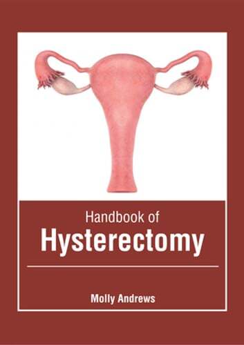 Handbook of Hysterectomy by Molly Andrews: New