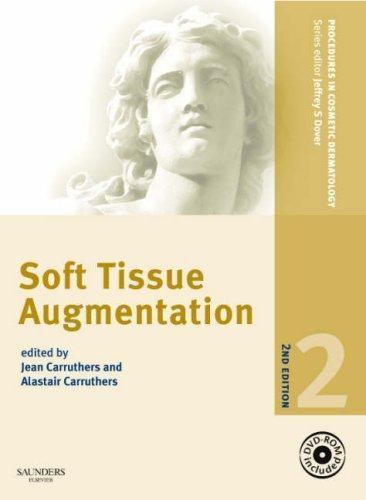 Procedures in Cosmetic Dermatology Series: Soft Tissue Augmentation with DVD:…